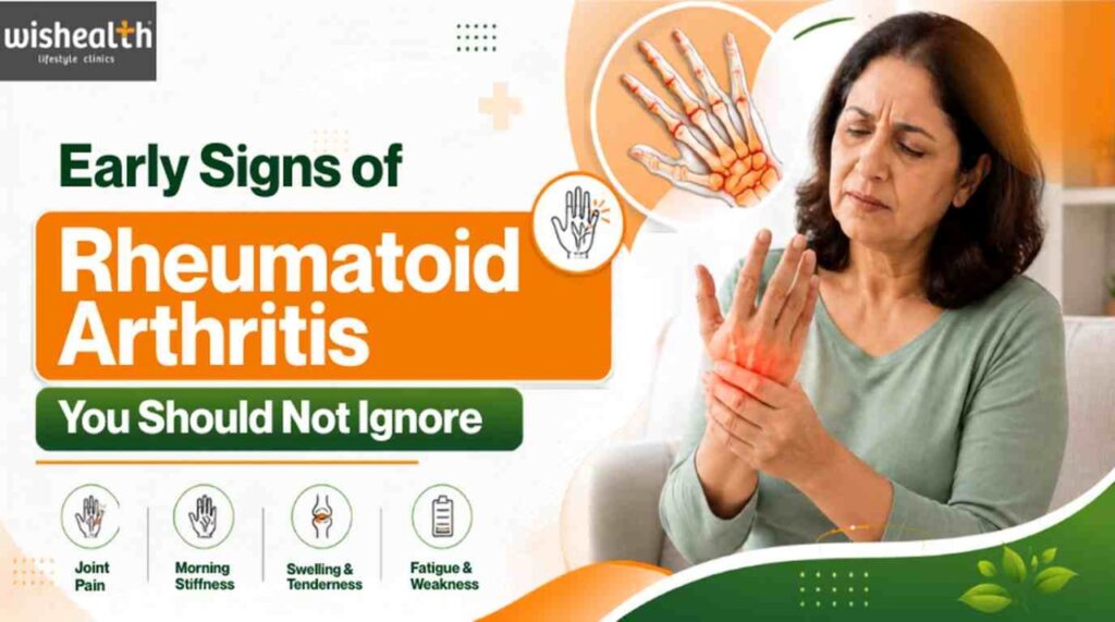 Early Signs of Rheumatoid Arthritis You Should Not Ignore